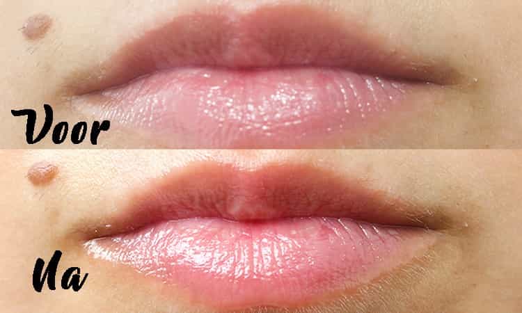 Filorga-Nutri-Filler Lips