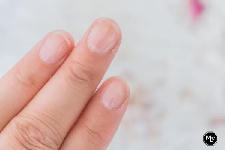 beschadigde nagels herstellen