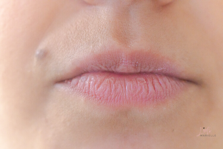 before lips
